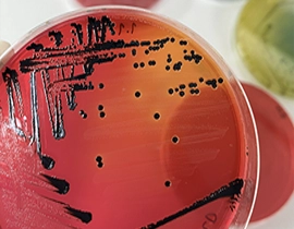 Muestra de laboratorio con Salmonella